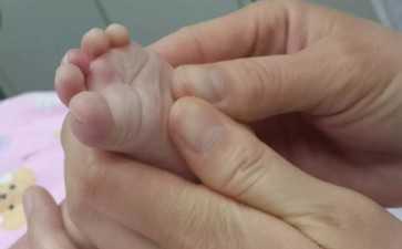 精子头部畸形对受孕有何影响？深度解析男性不育的常见诱因